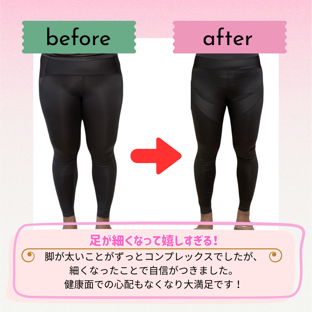 ビフォーアフター