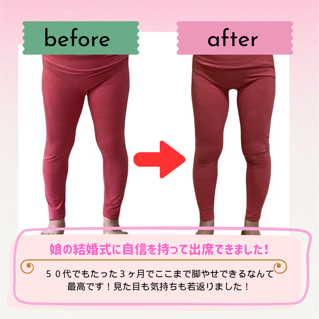 ビフォーアフター