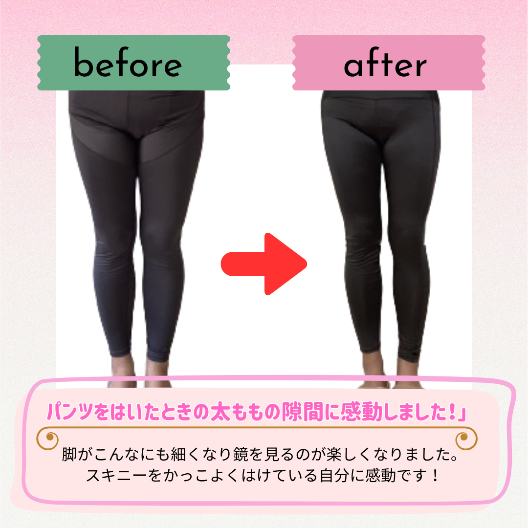 ビフォーアフター